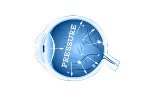  Diabetes &amp; Glaucoma